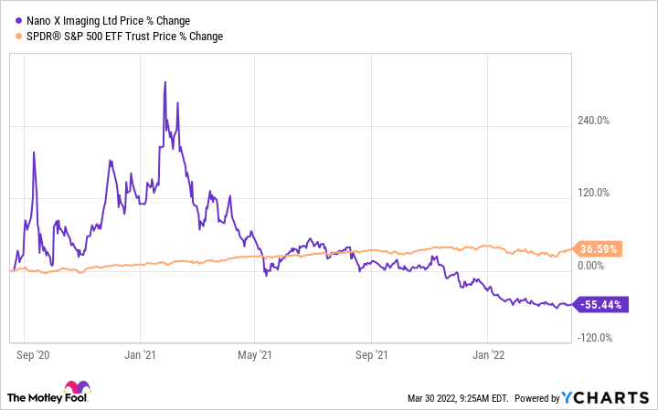 Nano-X Imaging Ltd. (NNOX) Is a Great Choice for 'Trend' Investors, Here's Why